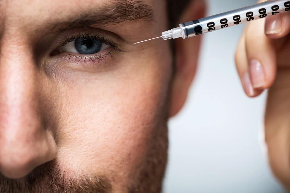 botox for men winnipeg-min