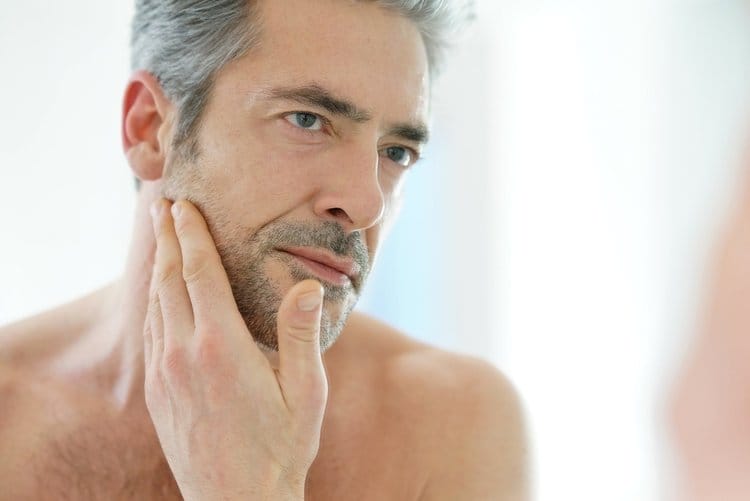chemical peels