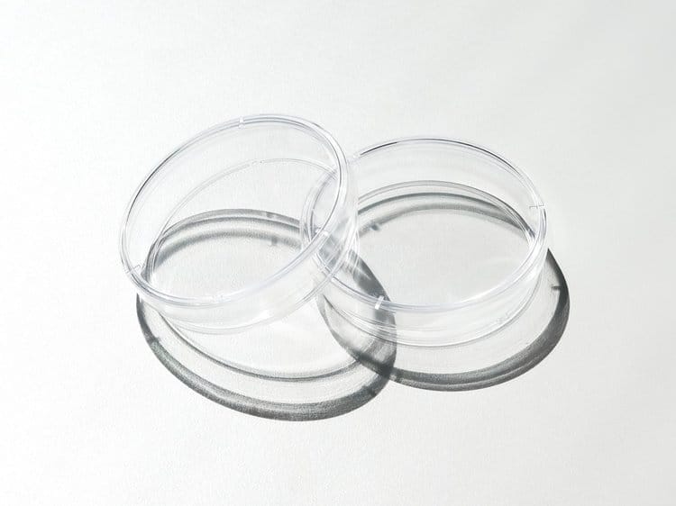 sperm retrieval winnipeg