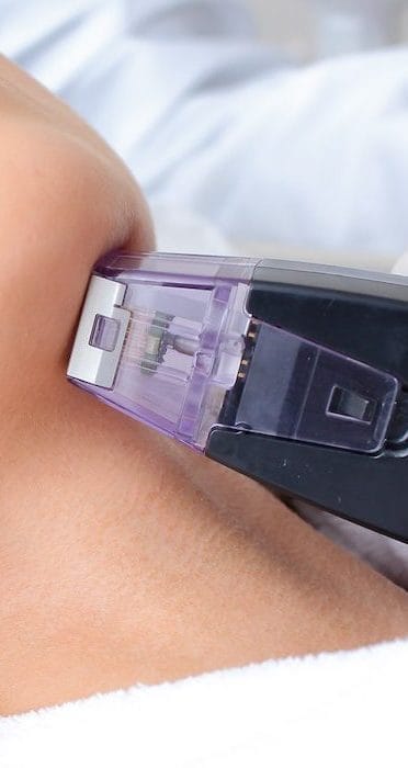 Morpheus8 1 min e1710797254246