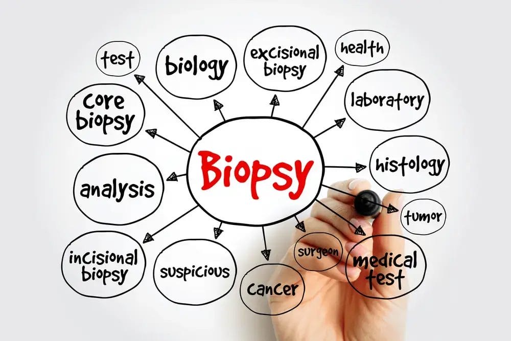 Biopsy Screening Method