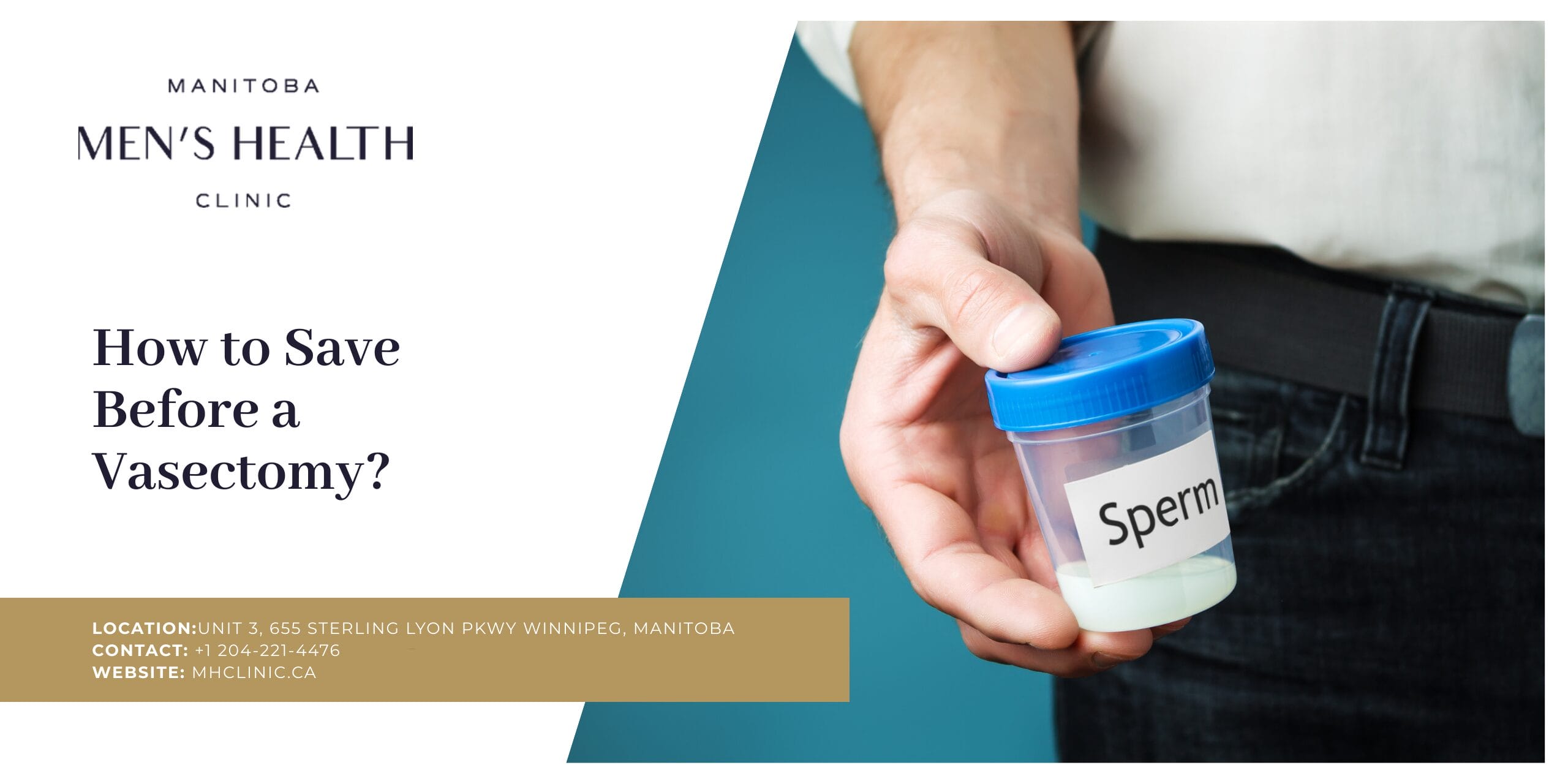 How to Save Before a Vasectomy